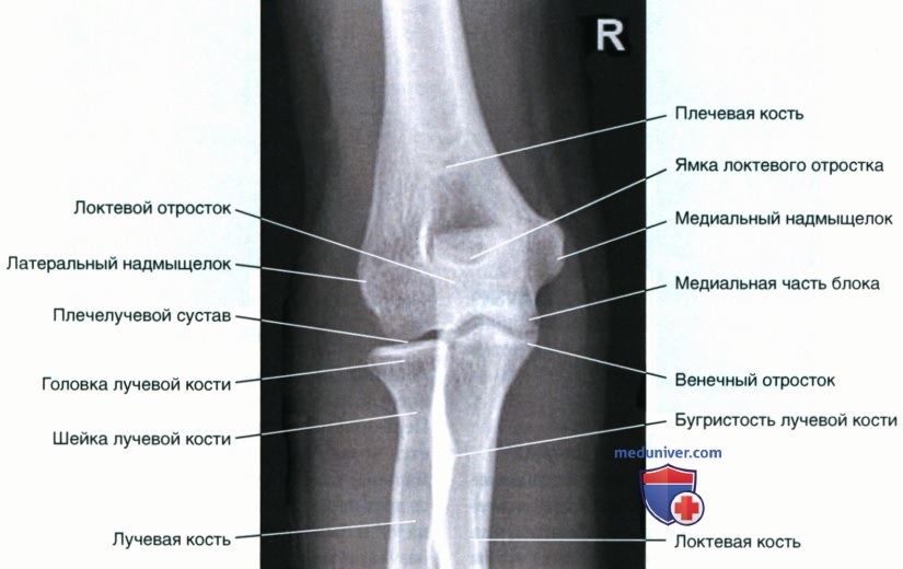 Укладка при рентгенограмме локтевого сустава в передне-задней проекции (ПЗ проекции)