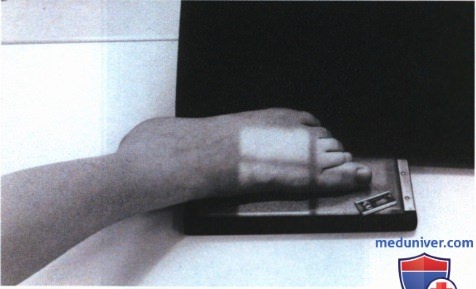 Укладка при рентгенограмме пальца стопы в косой ПЗ проекции