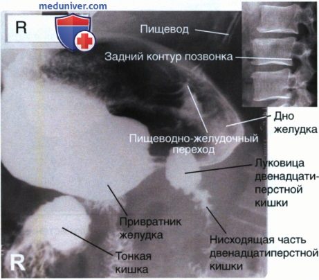 Укладка при рентгенограмме желудка и двенадцатиперстной кишки в боковой проекции