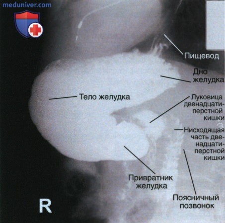 Укладка при рентгенограмме желудка и двенадцатиперстной кишки в боковой проекции