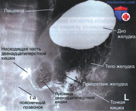 Укладка при рентгенограмме желудка и двенадцатиперстной кишки в косой ПЗ проекции