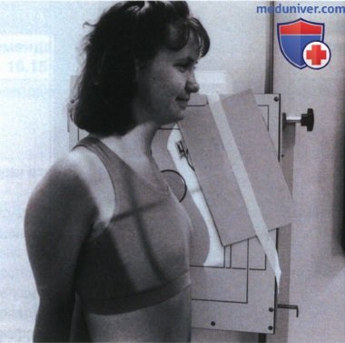 Укладка при рентгенограмме грудины в боковой проекции