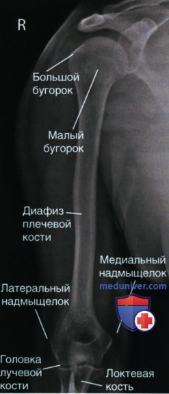 Укладка при рентгенограмме плечевой кости в передне-задней проекции (ПЗ проекции)
