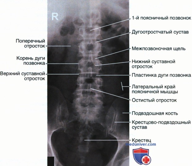 Укладка при рентгенограмме поясничных позвонков в ПЗ проекции