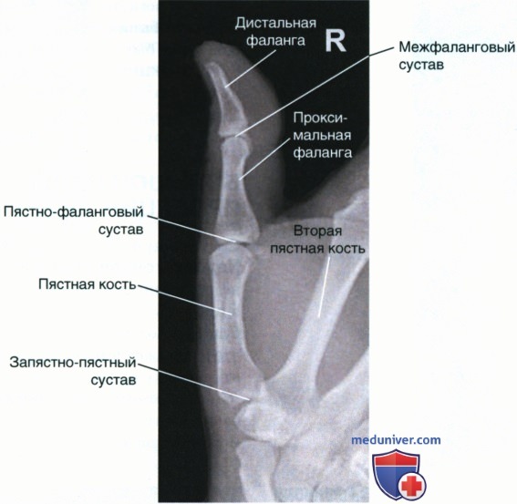 Укладка при рентгенограмме большого пальца кисти в боковой проекции