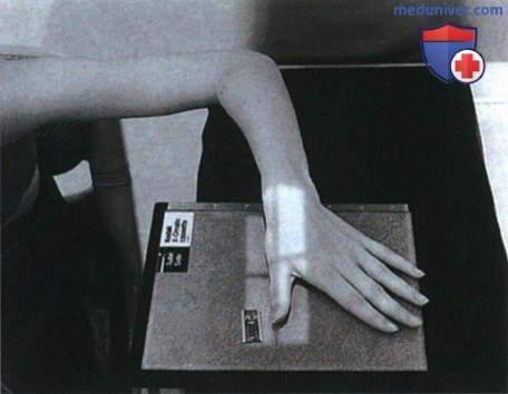 Укладка при рентгенограмме большого пальца кисти в косой ЗП проекции