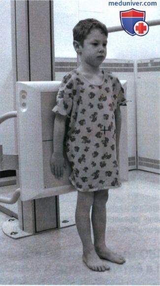 Укладка при рентгенограмме органов брюшной полости (ОБП) у детей старшего возраста стоя и лежа на спине в ПЗ проекции