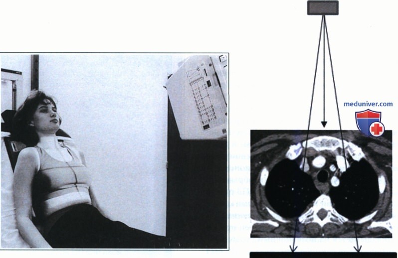 Укладка при рентгенограмме органов грудной клетки (ОГК) лежа на спине (передне-задней проекции)