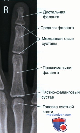 Укладка при рентгенограмме пальца руки в ЗП проекции