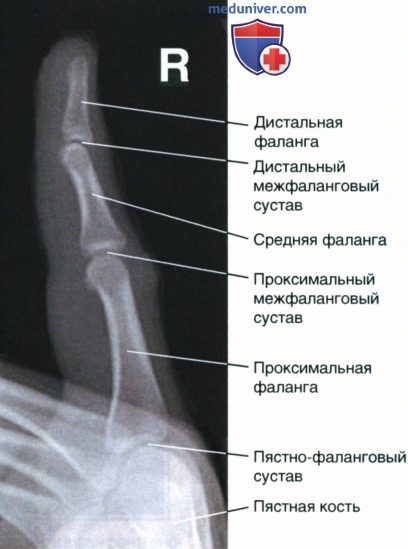 Укладка при рентгенограмме пальца кисти в боковой проекции
