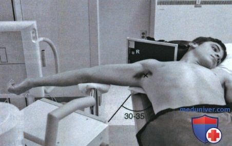 Укладка при рентгенограмме плечевого сустава в нижневерхней аксиальной проекции (метод Лоуренса)