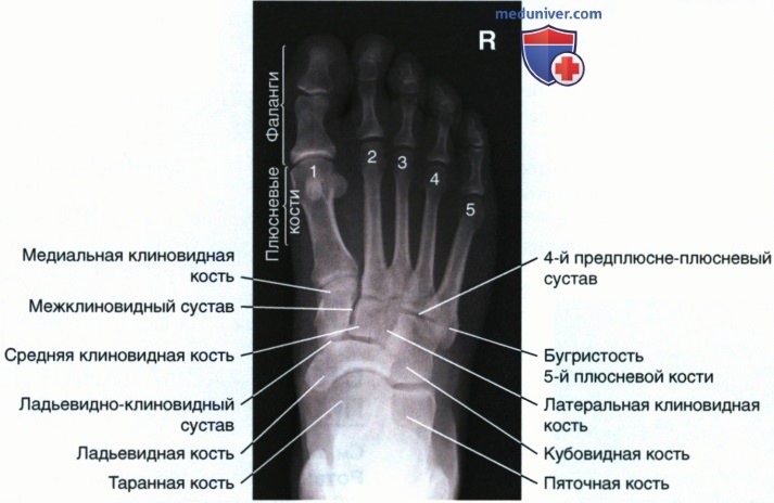 Укладка при рентгенограмме стопы в аксиальной ПЗ проекции (дорсоплантарной)