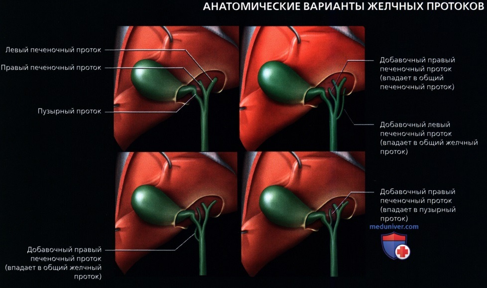 УЗИ анатомия желчных путей (биллиарного тракта) в норме