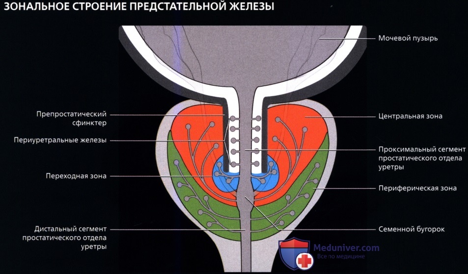 Части простаты. Зональная анатомия предстательной железы УЗИ. Зональная анатомия предстательной железы по MCNEAL. Семенной холмик предстательной железы. Парауретральные железы анатомия.