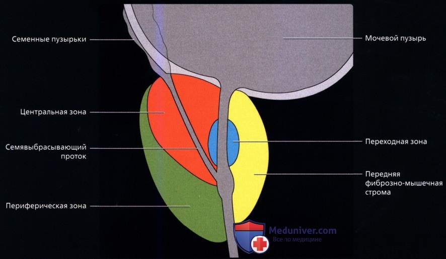 Части простаты. Схема долей предстательной железы. Доли предстательной железы анатомия. Предстательная железа у мужчин анатомия долей. Ультразвуковая анатомия предстательной железы.