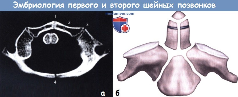 Эмбриология первого и второго шейных позвонков