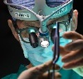 видео по нейрохирургии