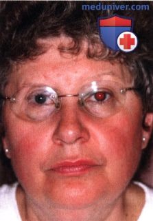 Операции при опухоли глазницы: варианты хирургического лечения
