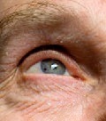 осложнения операций на глазах