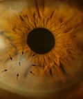 осмотр глаз пациента в офтальмологии
