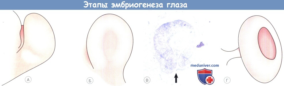 Из какого зародышевого листка образуется сетчатка глаза thumbnail