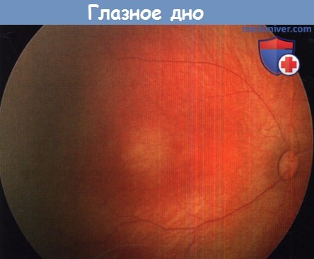 Metoda Stanislavsky în oftalmologie