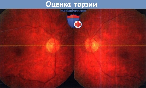 Офтальмо-РО thumbnail