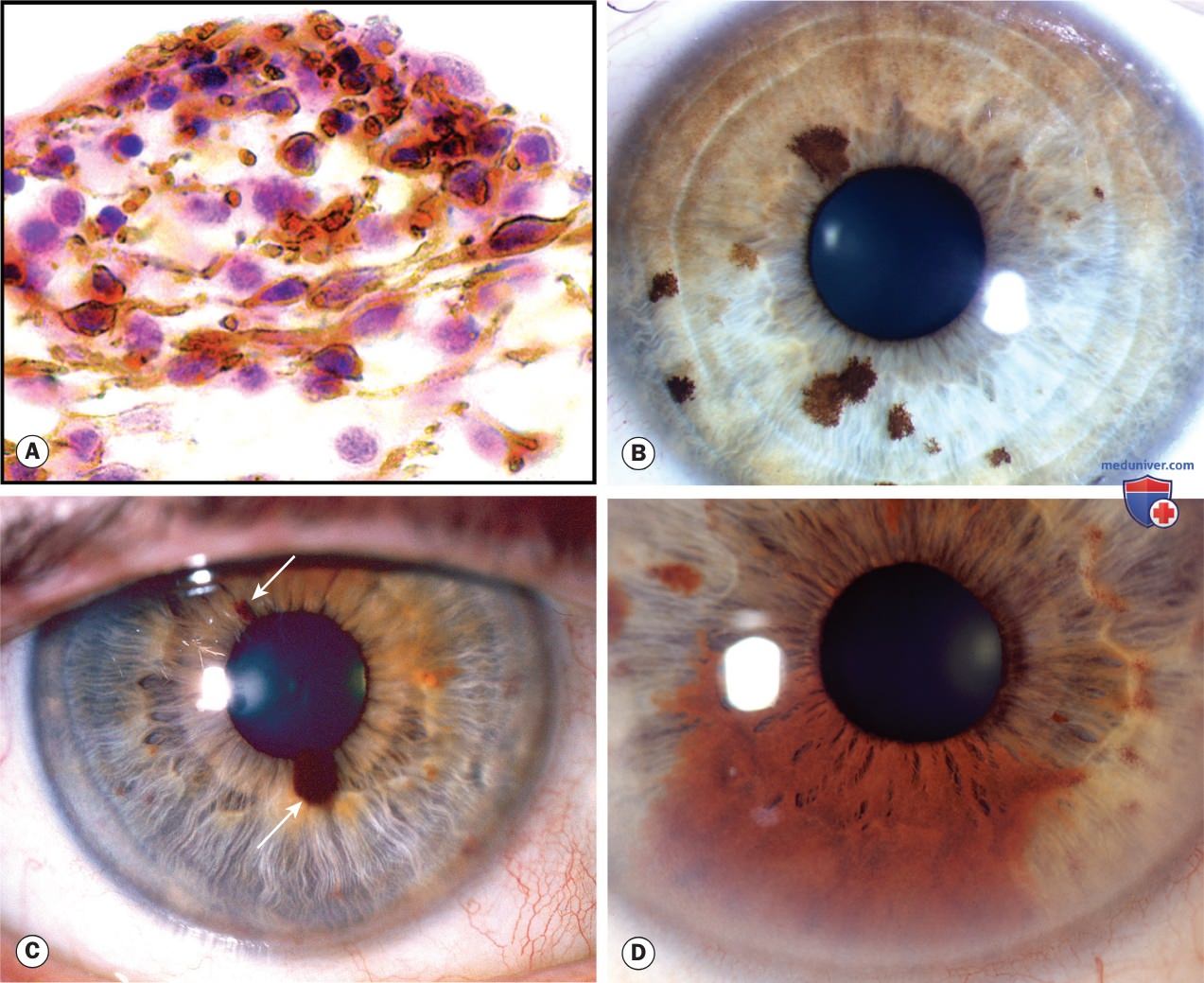 ������� �������