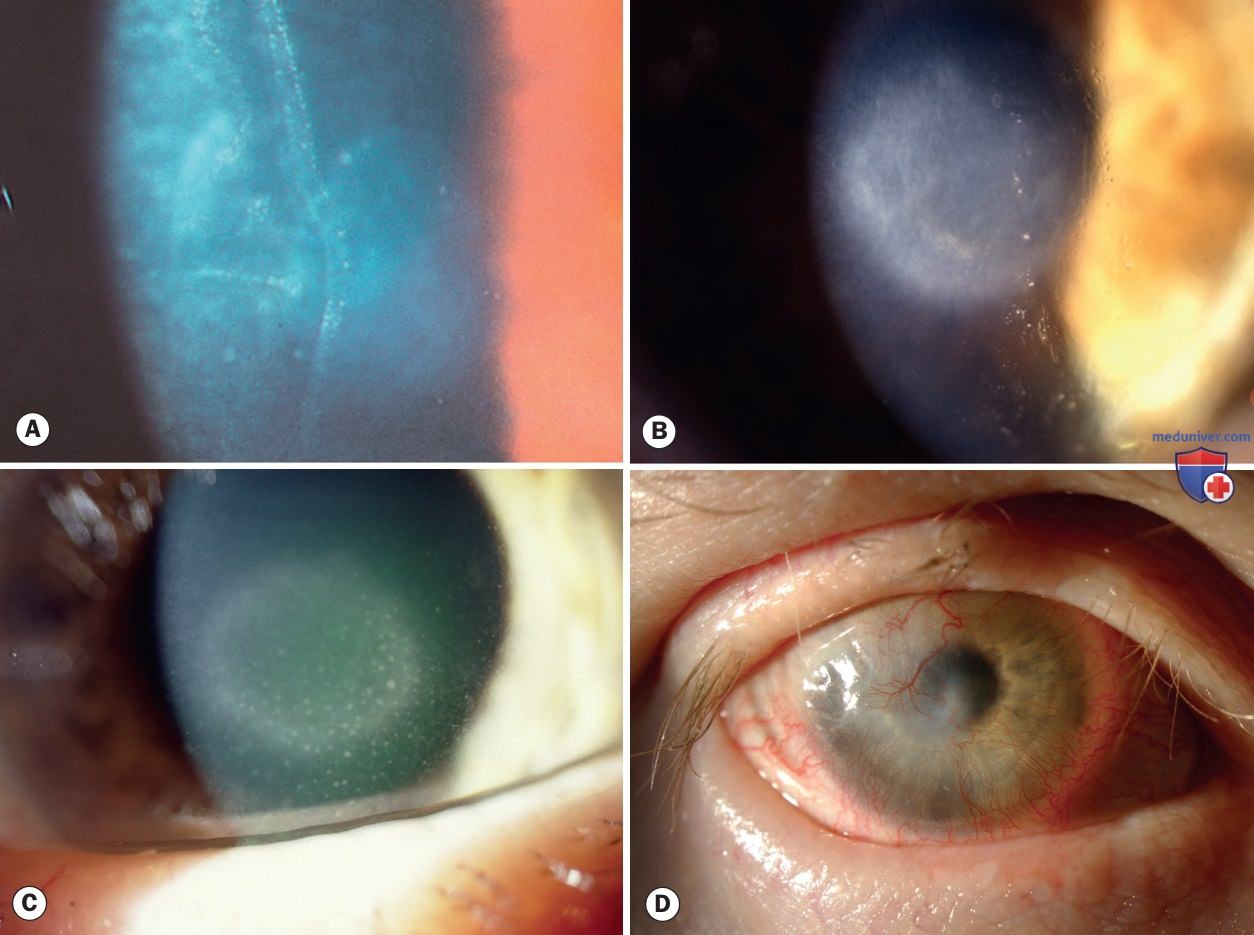 ������� ������ �������� ������� (���)
