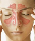 отоларингология - болезни носа и околоносовых пазух