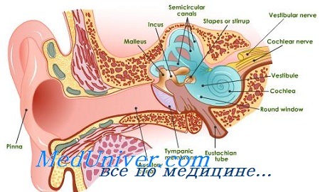 неврит слухового нерва