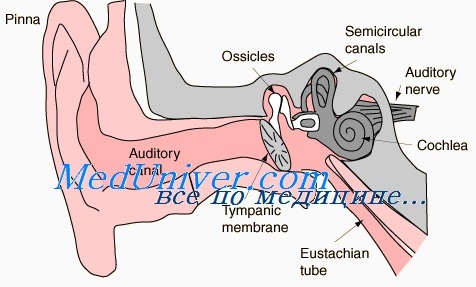 шум в ухе при отосклерозе