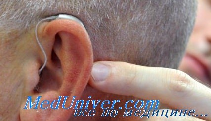 проблема шума в ушах