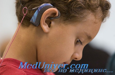 слуховой аппарат ребенку