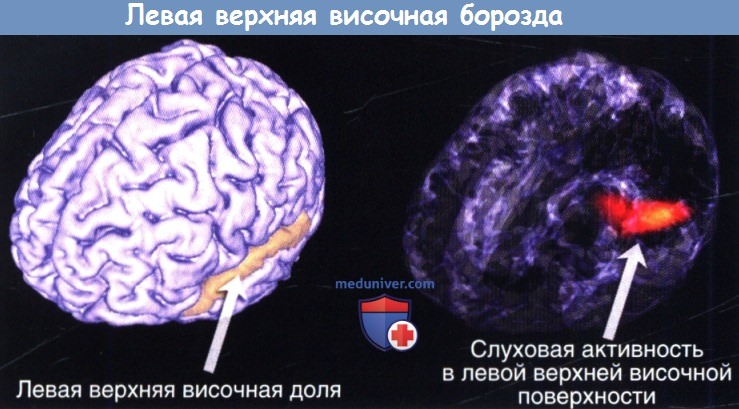 Слухова зона кори головного мозку розташована в thumbnail
