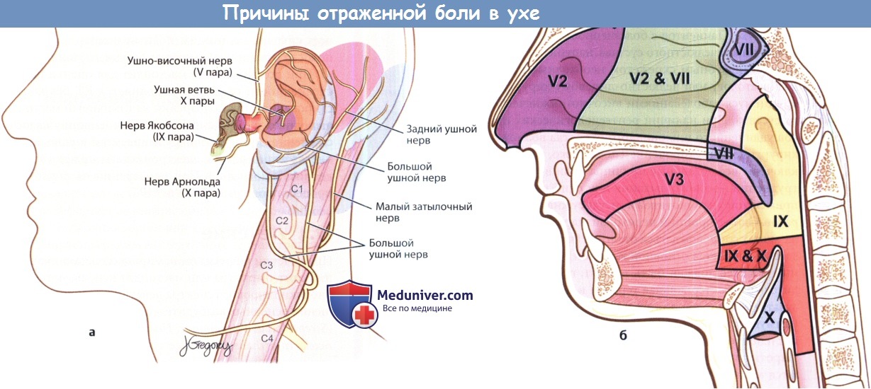 Причины отраженной боли в ухе