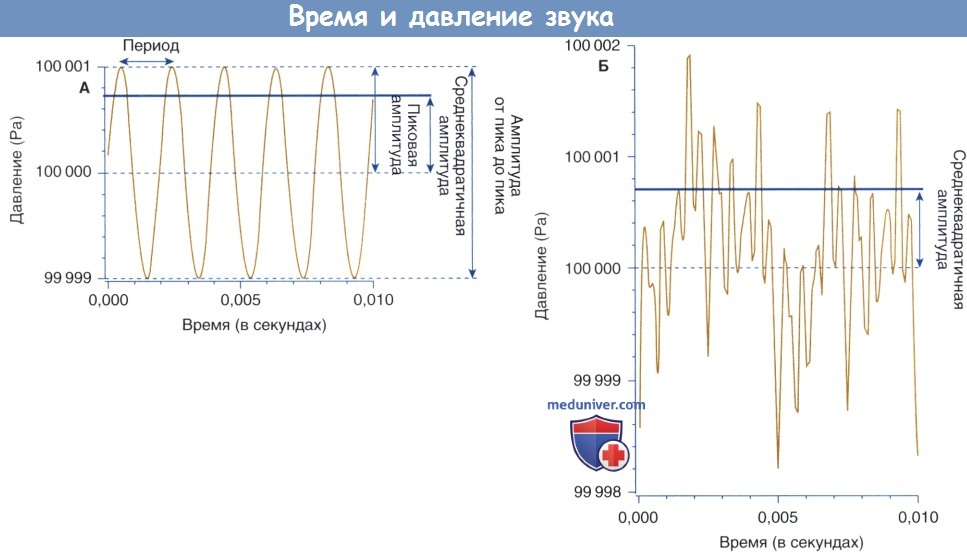 На рисунке представлены графики зависимости изменения давления воздуха от времени для звуковых волн