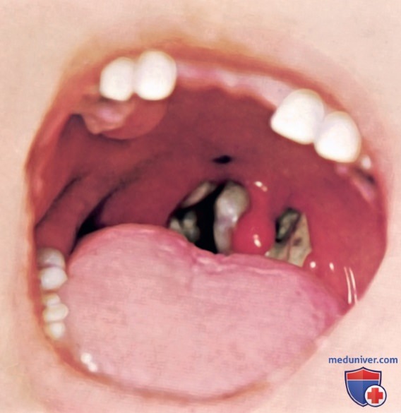 �������� (Corynebacterium diphtheriae) � �������