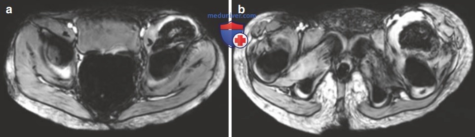 ������� ������ ������� ����������� � ������� 2 ��� � ���������� ������� - �������������� ��������