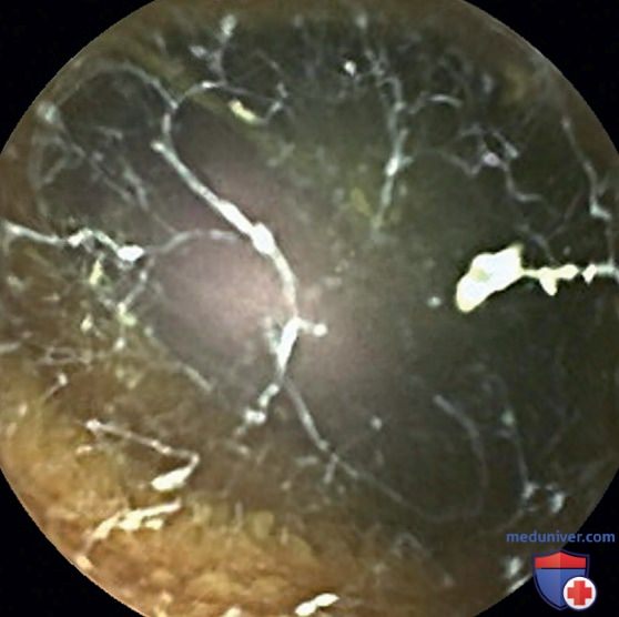������ �������� ������������� � ������� (����� ��������)