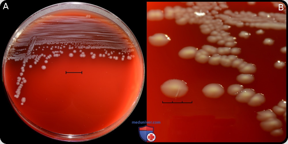 Plesiomonas shigelloides � �������