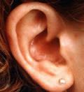 поражения внутреннего уха