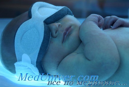 Фототерапия желтухи у новорожденного рожденного у резус-отрицательной матери