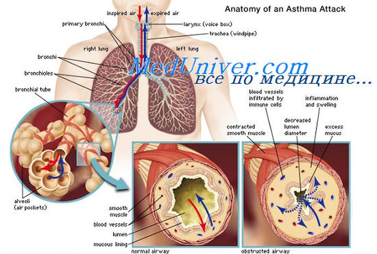 глюкокортикоиды при астме