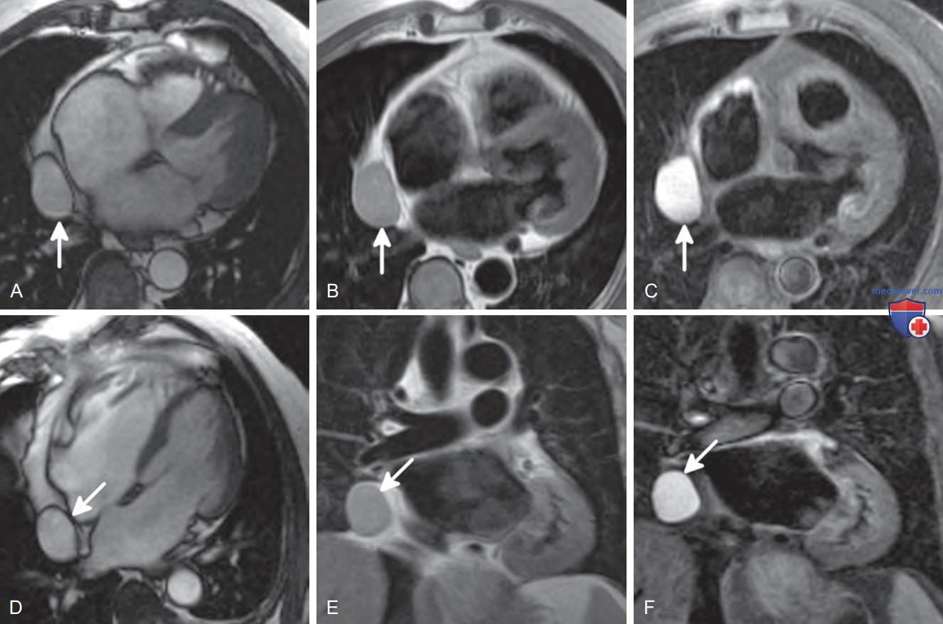 ��������������� ����� �� �� � ���