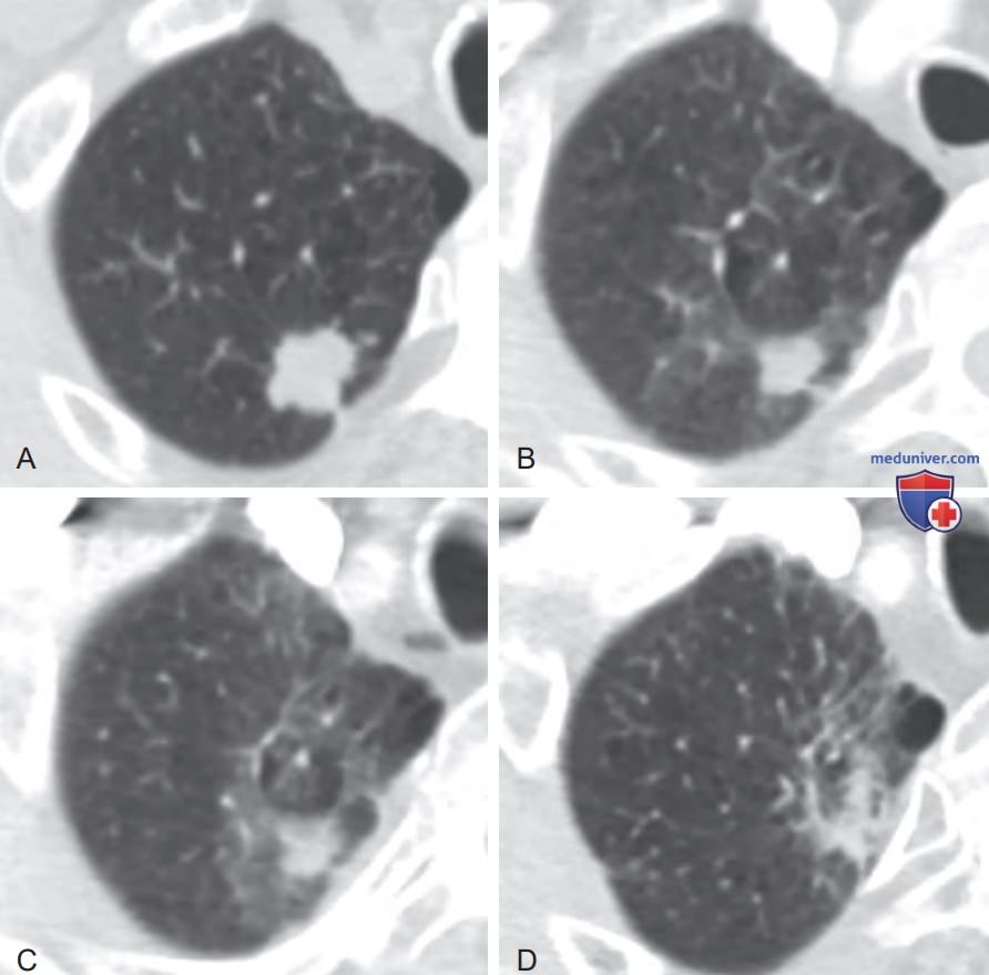 ������������ ������� ������� �� �������������� � ������������ ���������� (��)