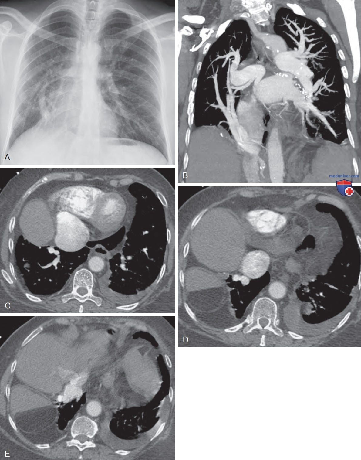 ������� �������� ����� �� �������������� � ������������ ���������� (��)