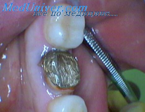стоматология и зубы