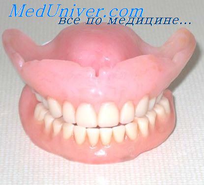 Лечение небного положения зубов thumbnail