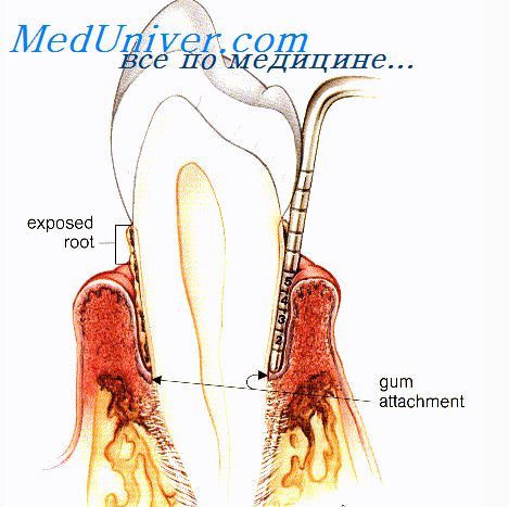 противовоспалительная терапия в стоматологии